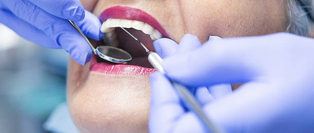 Best Chipped Tooth Repair Near Me  in San Juan Bautista, CA